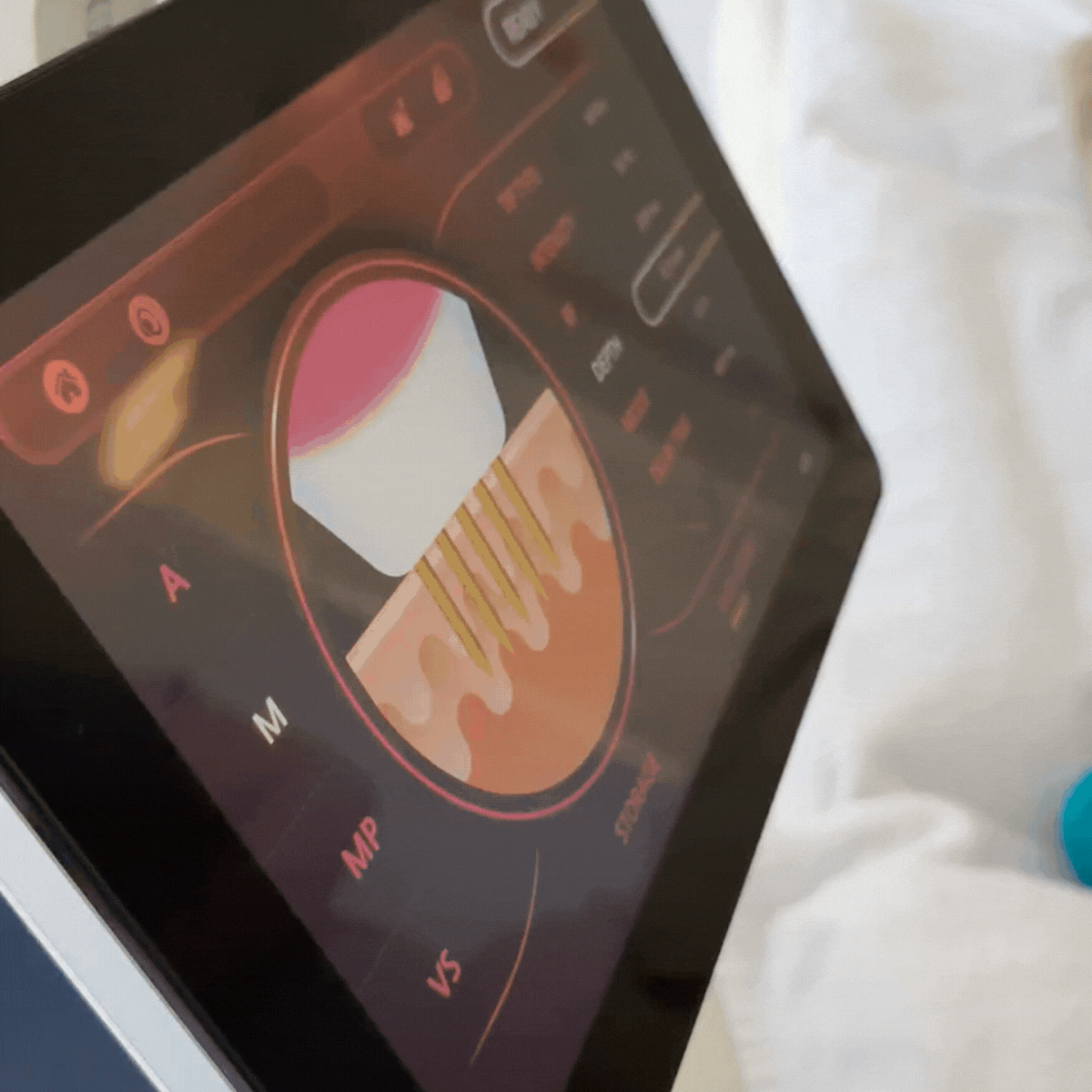 Leichte Bedienung – Touch-Display & Handstück